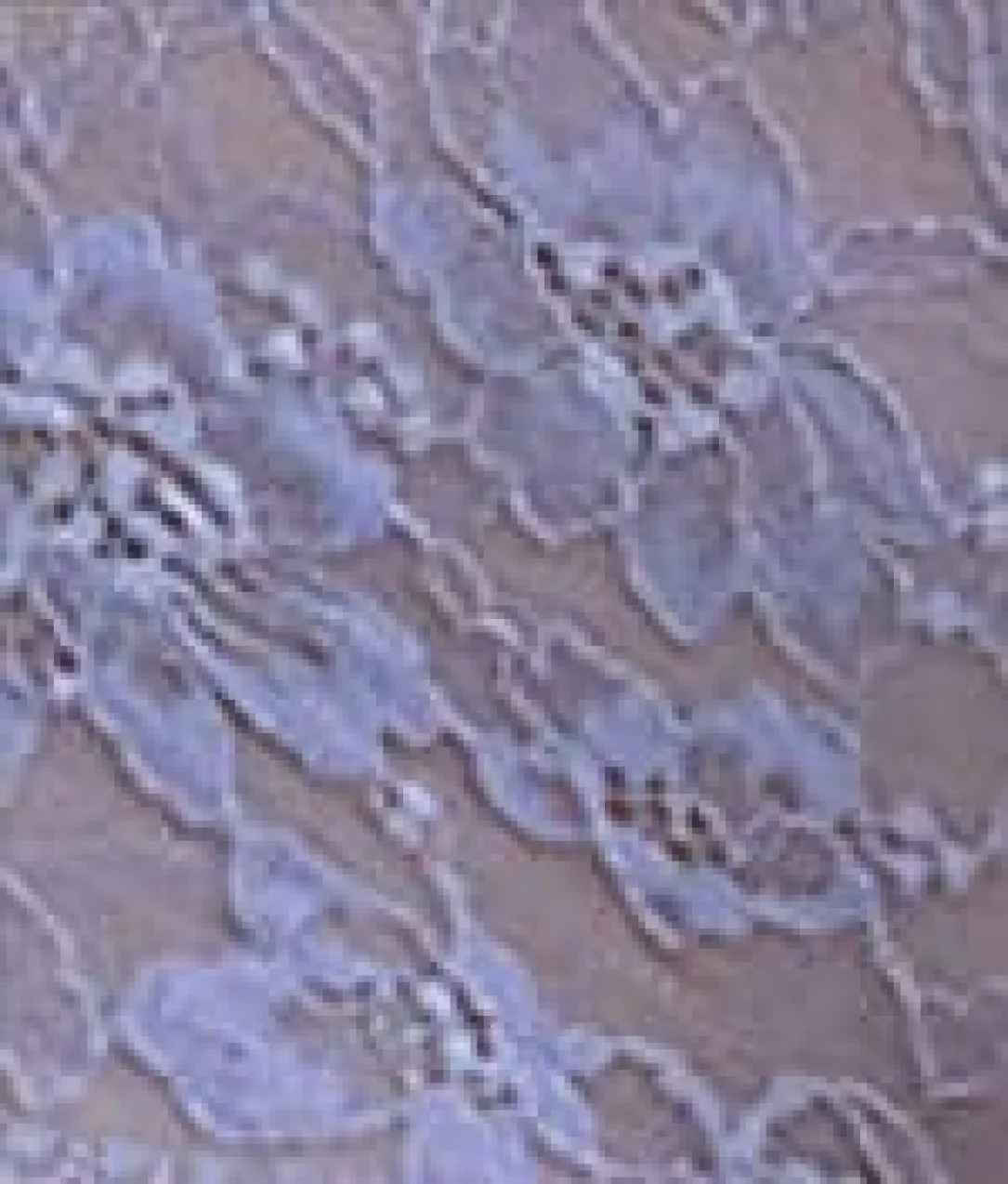 Lace Hipster